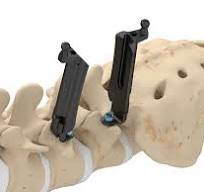 Invictus™ MIS Modular - ATEC Spine