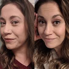 How to fix skin texture and pimples after changing skincare products?