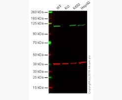 All antibody generation, polyclonal or monoclonal, begins with eliciting an immune response, termed immunization. Anti Insulin Antibody Ab7842 Is Not Available