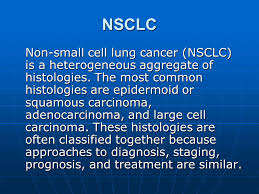 There are two main types of small cell lung cancer. Non Small Cell Lung Cancer Signs And Symptoms Persistent Cough Persistent Cough Trouble Breathing Trouble Breathing Chest Discomfort Chest Discomfort Ppt Download
