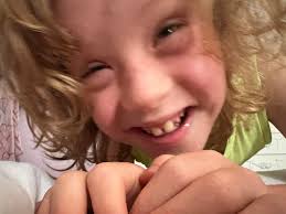 Little Boy With Special Condition Receives Love