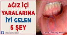 Agiz Ici Yaralarina Iyi Gelen 5 Sey Bu Yontemlerle Agiz Ici Yaralarinizdan Kurtulabilirsiniz Stres Recete Saglikli Yasam Tarzi