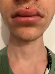 The labret or medusa piercing, just above the lip maintains a perfect distance with that of septum piercing. Only Got This Medusa Piercing Two Days Ago I M A Little Concerned It S Too Swollen Piercing