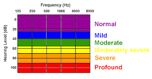 Hearing Loss Definitions