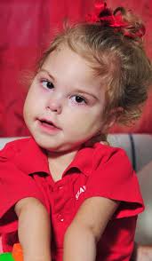 Public's generosity helps Wagga girl