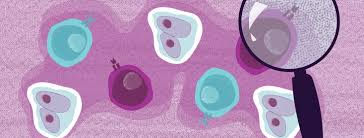 What Are Hodgkin And Non Hodgkin Lymphomas