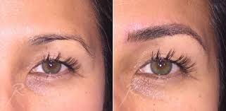 We did not find results for: Microblading Russak Aesthetic Centre New York City Ny
