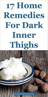 You can use the fresh lemon juice or lemon slice to reduce the pigmentation. How To Lighten Your Dark Inner Thighs 17 Home Remedies In 2020 Remove Dark Spots Brown Spots On Skin Dark Spots On Face