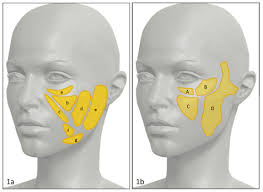 Anatomy And Aging Of Cheek Fat Compartments