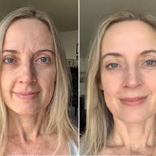 Rejuvenating and Anti-Aging Collagen Face Moisturizer with Stem Cells