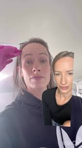 2 weeks post treatment! If you want less lines for the holidays, I have  some availability!, Book now!! 705.209.0500, #botoxbarrie #nurseinjector  #rninjector #barriespa #dysport #nolines #agelessskin ...