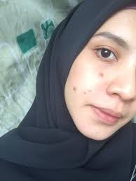 Hampas timun kemudian dijadikan sebagai masker dan dibiarkan selama 30 minit. Wanita Ini Kongsi Caranya Hilangkan Parut Jerawat Dengan Cepat Hanya Guna Masker Bedak Baby Hijabista
