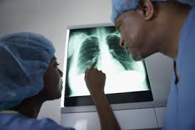 Median is the midpoint of. What Are My Chances Of Getting A X Ray Tech Job After Completing 128 Hours Of Training