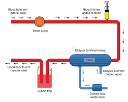 diagram of kidney dialysis machine stock vector