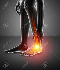 Même dans la vie de tous les jours, des blessures aux articulations de la cheville se produisent parfois, souvent par torsion des pieds. 3d Illustration De Pied Masculin Avec Douleur A La Cheville Banque D Images Et Photos Libres De Droits Image 70451817