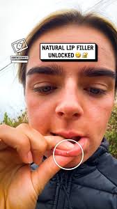 Feel like I've gotten lip filler... 😩🐝