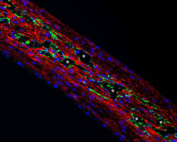 Imagem de 3Dprinted kidney tissue