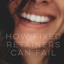 Check spelling or type a new query. How Fixed Retainers Can Fail Serenity Orthodontics Blog