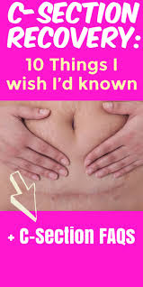 Pelvic floor physical therapists can help! C Sections Recovery 10 Things You Need To Know