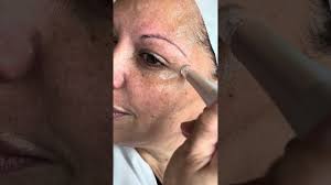 THE VIRAL REGENPEN™