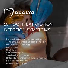 Image result for Tooth Extraction