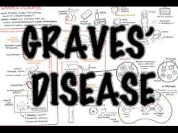 Graves' disease is an autoimmune disorder affecting approximately 0.3% of people living in the united states and 0.5% of the world population. Graves Disease Overview Causes Pathophysiology Investigations And Treatment Youtube