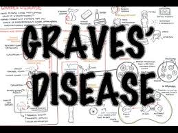 Graves' disease is an autoimmune disease that produces hyperthyroidism. Graves Disease Overview Causes Pathophysiology Investigations And Treatment Youtube