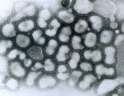 Gripe aviaria h5n6 en febrero en china. Gripe Aviaria Wikipedia La Enciclopedia Libre