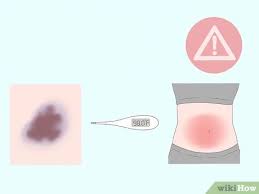 And after my period is over, i'll have brown vaginal spotting for a few days. 3 Ways To Identify Abnormal Vaginal Spotting Between Periods