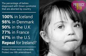 Down syndrome — Save Down Syndrome