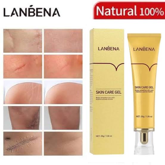 Lanbena TCM Scar and Acne Mark Removal Gel Ointment – 30gm | শক্তিশালী দাগ ও অ্যাকনে মার্ক দূর করার সমাধান - SHAN GALLERY