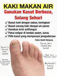 Saya telah membeli satu lagi krim, namanya candacor. ð—§ð—²ð—¹ð—²ð—´ð—¿ð—®ð—º On Twitter Tips Penjagaan Kaki How To Prevent Kaki Kusam