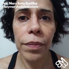 Mary Betty Bustillos Sanabria (@soymarybettytudoctora) • Instagram photos  and videos