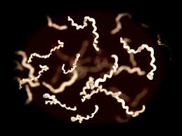 Lyme disease can affect the skin, joints, heart, and nervous system.; Borelioza Objawy Diagnoza Skutki I Leczenie