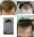 How Hair Grows On Head