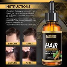 One is in a white bottle and called wild growth hair oil and the other comes in a yellow bottle and is called wild growth light moisturizing oil. Organic Wild Natural Private Label Minoxidi 5 Vitamins Serum Oil Spray Hair Growth Treatment China Hair Growth Serum And Hair Loss Serum Price Made In China Com
