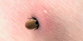 6 Simple Steps To Remove A Tick Correctly
