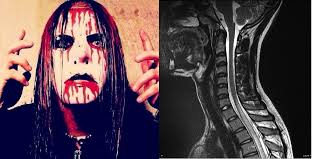 Listening back 14 year later it is still a pretty good performance and that is what you got back then. Joey Jordison Reveals He Had Rare Neurological Disorder Towards The End Of His Career In Slipknot Metalsucks