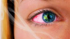 Why Does Weed Make Your Eyes Red And How To Get Rid Of Red Eyes