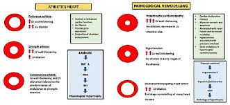 cardiac dysfunction and athletes heart new insights into