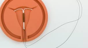 How long should one keep an iud on? Iud Period 12 Things To Expect Within The First Year After Inser