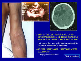 Specific medical conditions affect these structures with distinctive consistency and location. Ppt Contents A 24 Year Old Malay Secretary With A Facial Rash And Leg Swelling Powerpoint Presentation Id 3724259