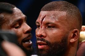 Aug 22, 2015 · let's have a look at some of the worst boxing injuries took place in the history of sport. Seven Most Gruesome Cuts In Boxing History From Badou Jack S Axe Wound To Mike Tyson Chomping Holyfield S Ear Off