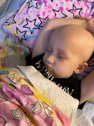 Update: Unfortunately being sedated for radiation has become too big of a  risk. Maeve's liver has become very large very quickly and her belly has  continued to need venting from her gtube.