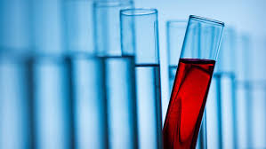 Vaterschaftstest Kosten So Teuer Ist Ein Dna Test Mannersache