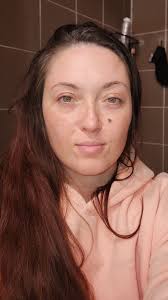 My eyes have so many freckles and my right eye has freckles in the shape of  a paw print that I didnt even discover until I was 38 and started working in