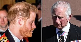 Prince Harry's Hair Loss Isn't Due To ...