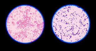 Since gram negative bacteria contain an outer membrane, they are less susceptible to antibiotics. Gram Positive Vs Gram Negative Biology Dictionary