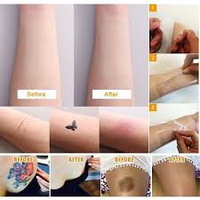 Birthmark Cover Up Tattoo Wish Tattoo Cover Up Sticker Breathable Tattoo Flaw Concealing Tape For Scar Birthmark Cover Up Sticker Flesh Colored Waterpro Kreativ Fotografering Kreativ