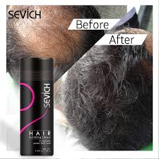 If you are tired of the same old hair care treatments that offer no results, try these chinese herbs for hair loss. China Best Hair Loss Treatment Product Best Hair Loss Treatment Product Wholesale Manufacturers Price Made In China Com